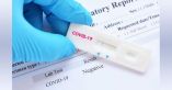 &Epsilon;&beta;&delta;&omicron;&mu;&alpha;&delta;&iota;&alpha;ί&omicron; &pi;&rho;ό&gamma;&rho;&alpha;&mu;&mu;&alpha; &Delta;&omega;&rho;&epsilon;ά&nu; Rapid Test &alpha;&pi;ό 31.05.21 έ&omega;&sigmaf; 06.06.21 &sigma;&epsilon; &pi;&epsilon;&rho;&iota;&omicron;&chi;έ&sigmaf; &tau;&omicron;&upsilon; &Delta;ή&mu;&omicron;&upsilon; &Beta;έ&rho;&omicron;&iota;&alpha;&sigmaf;