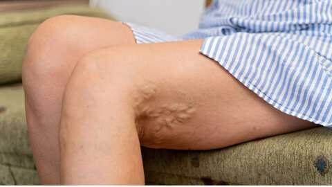 &Upsilon;&gamma;&epsilon;ί&alpha;: &Chi;&rho;ή&sigma;&iota;&mu;&epsilon;&sigmaf; &alpha;&pi;&alpha;&nu;&tau;ή&sigma;&epsilon;&iota;&sigmaf; &gamma;&iota;&alpha; &tau;&omicron;&upsilon;&sigmaf; &kappa;&iota;&rho;&sigma;&omicron;ύ&sigmaf; &kappa;&alpha;&iota; &tau;&eta; &theta;&epsilon;&rho;&alpha;&pi;&epsilon;ί&alpha; &tau;&omicron;&upsilon;&sigmaf;